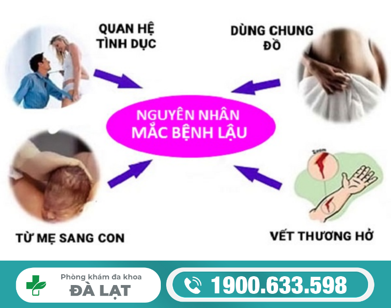 Hình ảnh minh họa